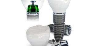 Prezentacja technologii implantów zębowych