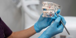 Instrumenty stomatologiczne demonstrujące uzębienie (Autorstwo: freepik)